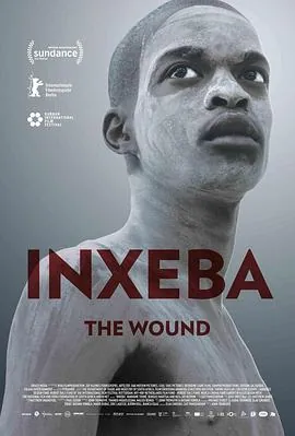 伤口Inxeba